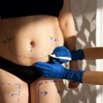 Sore or Cracked Nipple and What to Do