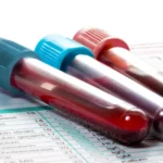 Foods that improve hemoglobin in blood