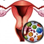 Effect of Diabetes on Baby Fetus