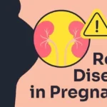 Kidney Infections in Pregnancy