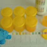 Preeclampsia during Pregnancy