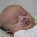 Health Problems for a Premature Baby