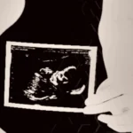 Dizziness and Pregnancy