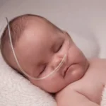 Pneumonia in babies