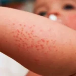 Respiratory illnesses in newborn